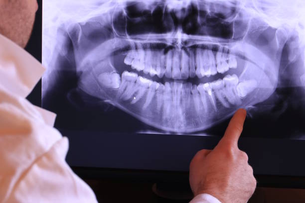 Best Knocked-Out Tooth Emergency  in Moundsville, WV